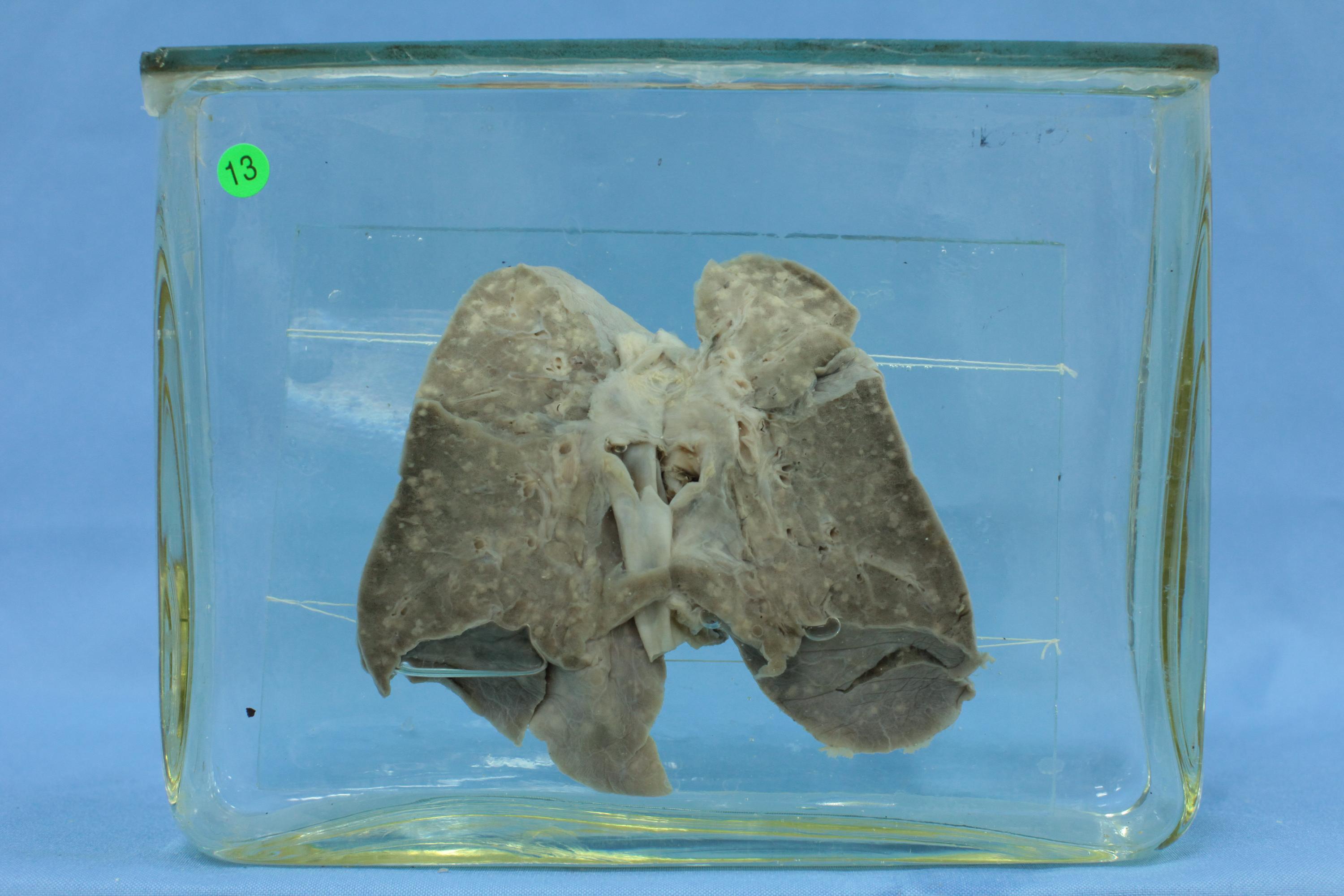 肺解剖图结构
